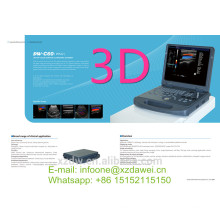 appareil d&#39;échographie portable et doppler couleur et appareil d&#39;échographie portable 3D DW-C60